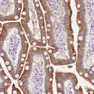 Anti-HSD17B2 antibody produced in rabbit 