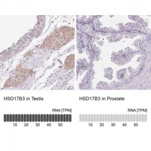 Anti-HSD17B3 antibody produced in rabbit 