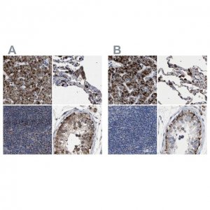 Anti-HSD17B4 antibody produced in rabbit 