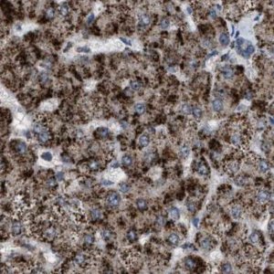 Anti-HSD17B4 antibody produced in rabbit 