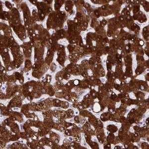Anti-HSD17B6 antibody produced in rabbit 