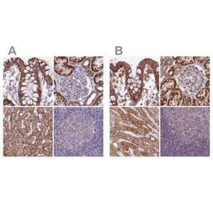 Anti-HSDL2 antibody produced in rabbit 