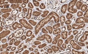 Anti-HSP60 Antibody, clone 1N3, ZooMAb Rabbit Monoclonal 