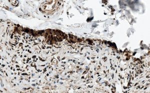 Anti-HSP70 Antibody, clone 4E12 ZooMAb Rabbit Monoclonal 
