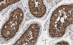 Anti-HSP90 alpha Antibody, clone 4M13 ZooMAb Rabbit Monoclonal 