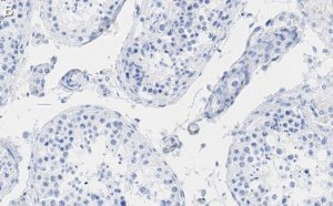 Anti-HSP90 alpha Antibody, clone 4M13 ZooMAb Rabbit Monoclonal 