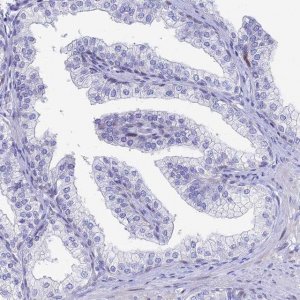 Anti-HSPA1L antibody produced in rabbit 