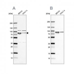 Anti-HSPA5 antibody produced in rabbit 