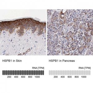 Anti-HSPB1 antibody produced in rabbit HPA000497-100UL