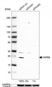 Anti-HSPB8 antibody produced in rabbit 