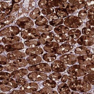 Anti-HSPBAP1 antibody produced in rabbit 