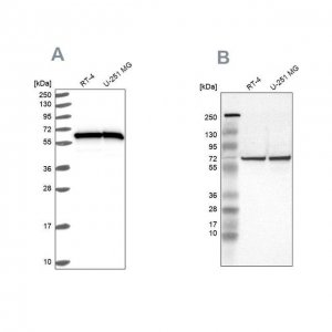 Anti-HSPD1 antibody produced in rabbit 