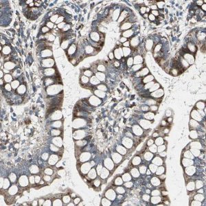 Anti-HTATIP2 antibody produced in rabbit HPA006417-100UL
