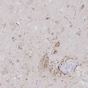 Anti-HTR2A antibody produced in rabbit 