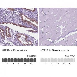 Anti-HTR2B antibody produced in rabbit 