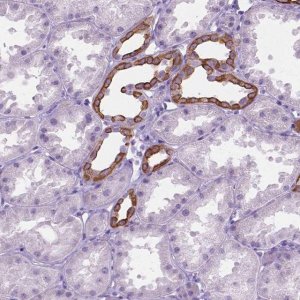 Anti-HTR2B antibody produced in rabbit 