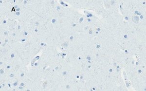 Anti-Huntingtin Protein Antibody, clone 1M11, ZooMAb Rabbit Monoclonal 