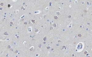 Anti-Huntingtin Protein Antibody, clone 1M11, ZooMAb Rabbit Monoclonal 