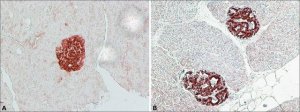 Anti-IAPP (N-terminal) antibody produced in rabbit SAB4200494-200UL
