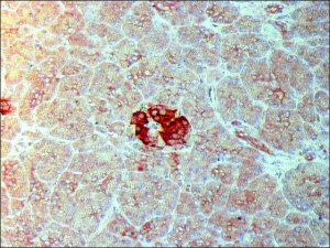 Anti-IAPP (N-terminal) antibody produced in rabbit SAB4200494-200UL