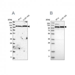 Anti-IARS2 antibody produced in rabbit HPA024596-100UL