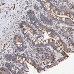 Anti-IARS2 antibody produced in rabbit HPA024596-100UL