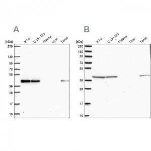 Anti-IDH3B antibody produced in rabbit 