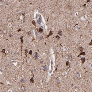Anti-IDH3G antibody produced in rabbit 