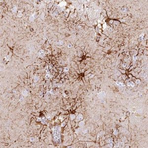 Anti-IFIT5 antibody produced in rabbit 