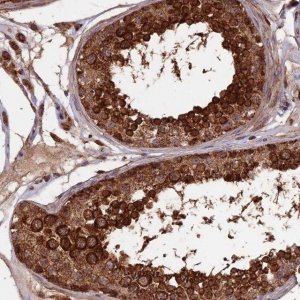 Anti-IFT22 antibody produced in rabbit 
