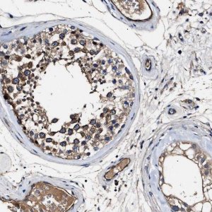 Anti-IFT81 antibody produced in rabbit 