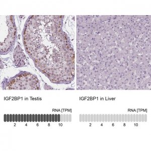 Anti-IGF2BP1 antibody produced in rabbit 