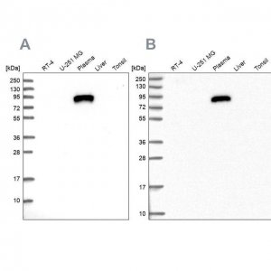 Anti-IGFALS antibody produced in rabbit 