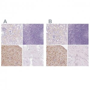 Anti-IGFBP1 antibody produced in rabbit 