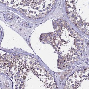 Anti-IGSF11 antibody produced in rabbit HPA046377-100UL