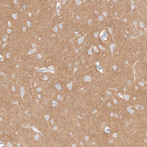 Anti-IGSF21 antibody produced in rabbit HPA044535-100UL