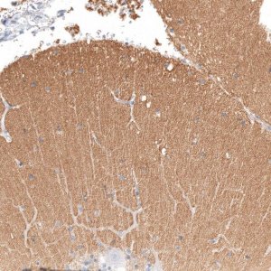 Anti-IGSF21 antibody produced in rabbit HPA044535-100UL
