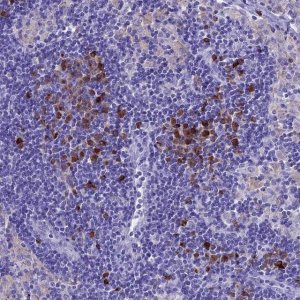 Anti-IGSF6 antibody produced in rabbit 