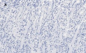 Anti-IKB Antibody, clone 6O8, ZooMAb Rabbit Monoclonal 