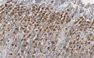 Anti-IKB Antibody, clone 6O8, ZooMAb Rabbit Monoclonal 