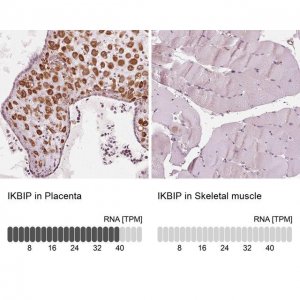 Anti-IKBIP antibody produced in rabbit 