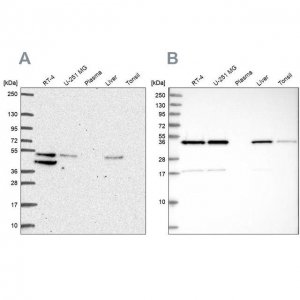 Anti-IKBIP antibody produced in rabbit 