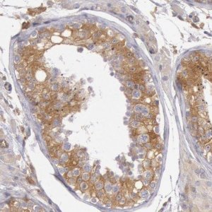 Anti-IKBKB antibody produced in rabbit 