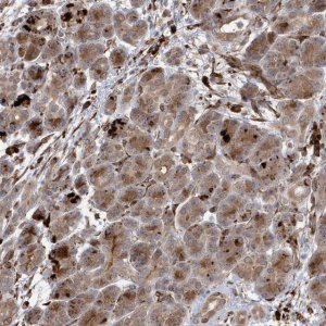 Anti-IL1RAPL2 antibody produced in rabbit 