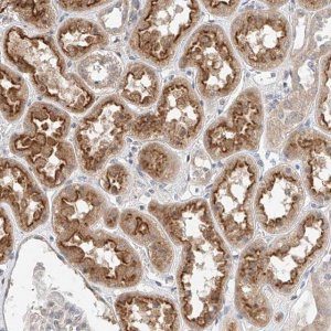 Anti-IL22RA2 antibody produced in rabbit 