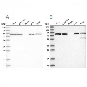 Anti-IMMT antibody produced in rabbit 