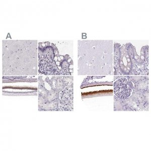 Anti-IMPG1 antibody produced in rabbit 