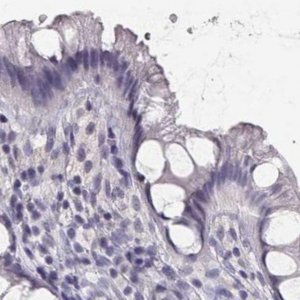 Anti-IMPG1 antibody produced in rabbit 