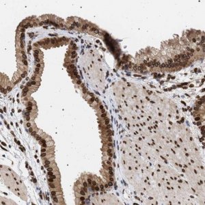 Anti-ING2 antibody produced in rabbit 