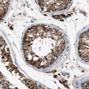 Anti-INHA antibody produced in rabbit 